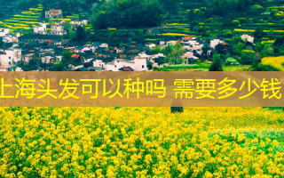 上海头发可以种吗 需要多少钱