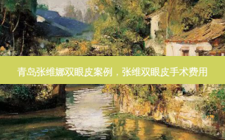 青岛张维娜双眼皮案例，张维双眼皮手术费用