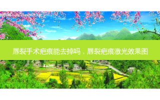 唇裂手术疤痕能去掉吗，唇裂疤痕激光效果图