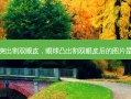 眼球突出割双眼皮，眼球凸出割双眼皮后的图片是什么