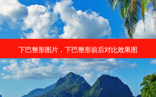 下巴整形图片，下巴整形前后对比效果图
