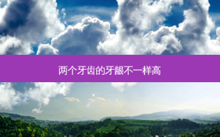 两个牙齿的牙龈不一样高