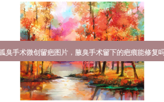 狐臭手术微创留疤图片，腋臭手术留下的疤痕能修复吗