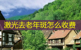 激光去老年斑怎么收费