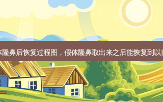 假体隆鼻后恢复过程图，假体隆鼻取出来之后能恢复到以前吗