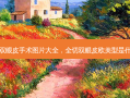 割双眼皮手术图片大全，全切双眼皮欧美型是什么