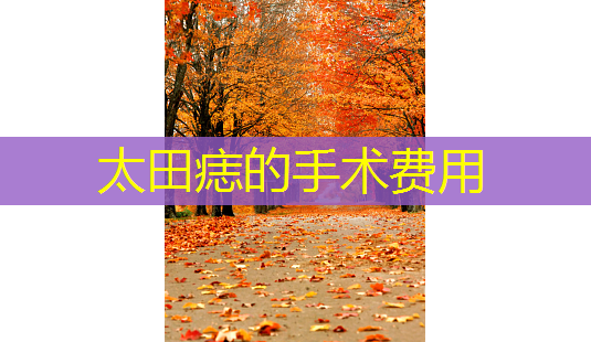 太田痣的手术费用-第1张图片-南山整形网 太田痣的手术费用-第1张图片-南山整形网