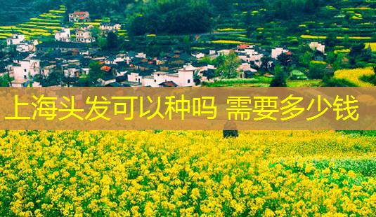 上海头发可以种吗 需要多少钱-第1张图片-南山整形网 上海头发可以种吗 需要多少钱-第1张图片-南山整形网