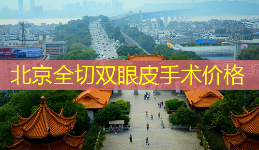 北京全切双眼皮手术价格-第1张图片-南山整形网 北京全切双眼皮手术价格-第1张图片-南山整形网